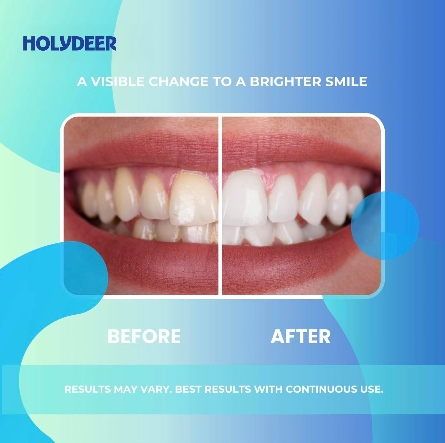 Nano-Hydroxyapatite Toothpaste, Mint, 7.5% nHAP, Fluoride-Free, Sensitive Whitening, Enamel Strengthening, 4.23 oz - Image 7